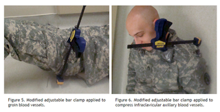 Illustration for article titled Battlefield ER: Combat Medicine Fights To Keep More Troops Alive